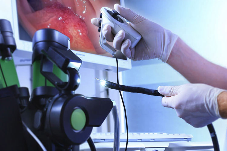Endoskopi nedir? ne zaman gereklidir?