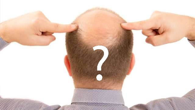 Saç ekimi işlemi hakkında sıkça sorulan sorular