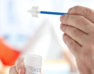 Smear testi nedir