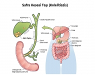 Safra Kesesi Nedir?