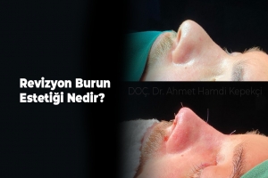 Revizyon Burun Estetiği Nedir