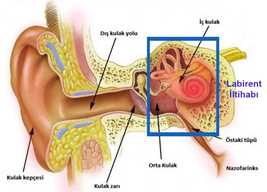 Orta kulak ameliyatları