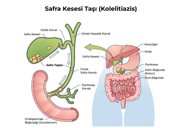 Safra Kesesi Nedir?