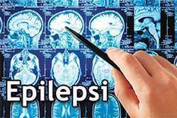 Epilepsi'de doğru yöntem ile tedavi önemlidir
