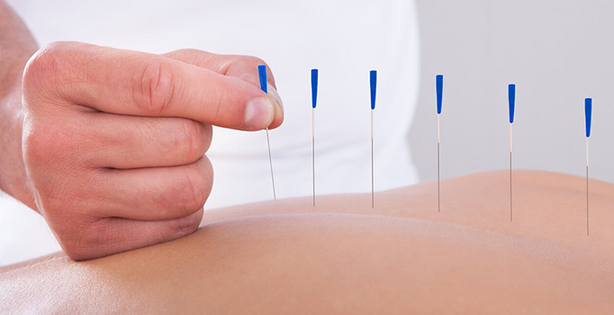 Akupunktur ile zayıflama